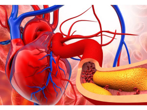 Dědičně zvýšený cholesterol je hrozba, Češi ho příliš neřeší