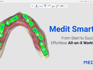 Revoluce v All-on-X: Převratná procedura společnosti Medit míří na trh